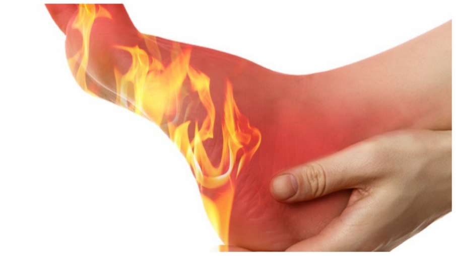 burning-feet-in-hindi-1669540874