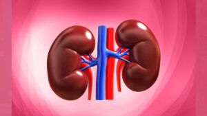 kidney