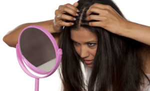 dandruff-home-remedies