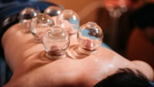 what-is-cupping-therapy-and-its-benefits-know-in-hindi