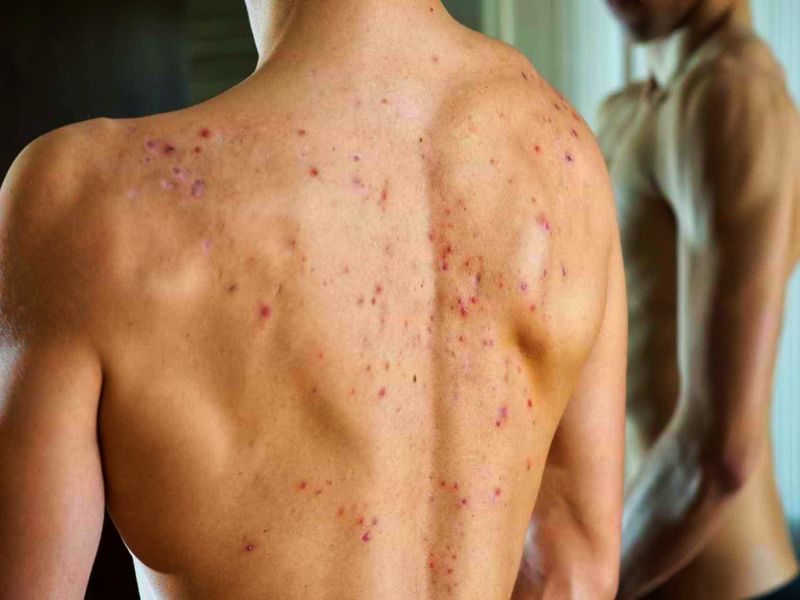 early-signs-and-symptoms-of-sepsis-or-septicemia_201909115806