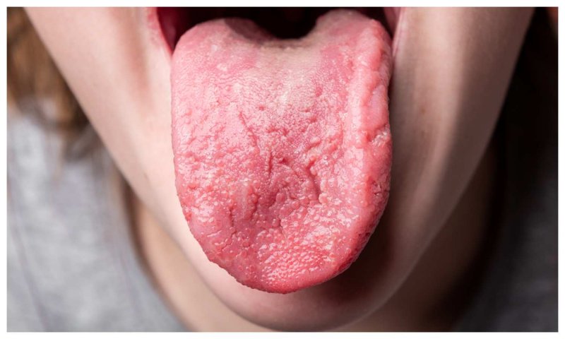 image_800x_640ed9aa4bdbe